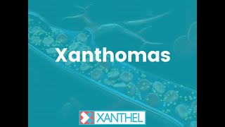 XANTHOMAS  How To Easily Remove Eyelid Xanthomas   Brought To You By XANTHEL® [upl. by Behrens]