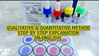 Widal test for typhoid feverQualitative amp Quantitative methodProcedure amp result interpretation [upl. by Dekow]