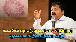 உடலில் ஏற்படும் பூஞ்சை தொற்று குணமாக இயற்கை வைத்தியம்DrSivaraman speech on fungal infection remedy [upl. by Nauqyaj886]