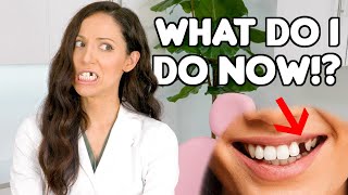 How To REPLACE A Missing Tooth Best Tooth Replacement Options [upl. by Navillus]