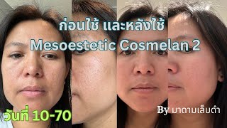 รีวิว Mesoestetic Cosmelan 2 [upl. by Karna]