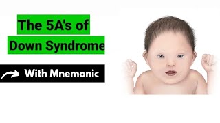 5 As Of Down Syndrome Mnemonic  Pediatrics Mnemonics  Dr Mubashar Ata [upl. by Gage]