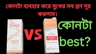 clindax lotion ReviewClinex Lotion ReviewHow to use Clinex LotionHow to use clindax LotionBangla [upl. by Oisangi949]