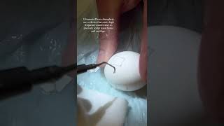 Ultrasonic Piezo Rhinoplasty on an Egg  8 West Clinic  Vancouver BC [upl. by Merta474]