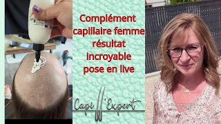 Complément Capillaire femme résultat incroyable [upl. by Weinshienk]