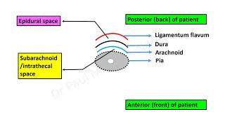 Opioids in Spinal and Epidural Analgesia [upl. by Eilatam145]