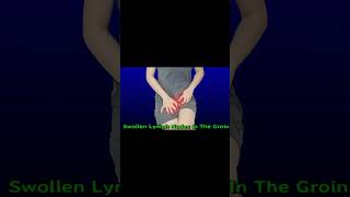 Swollen Lymph Nodes In The Groin shorts healthyshorts [upl. by Neille]