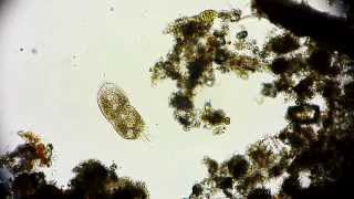 Stylonychia Wimpertierchen  Ciliate  Ciliophora  Ciliata  microorganisms under microscope [upl. by Yellac]