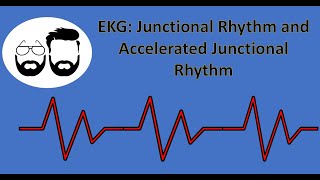 EKG Series Junctional Rhythm Accelerated Junctional Rhythm and Junctional Tachycardia [upl. by Iaka]