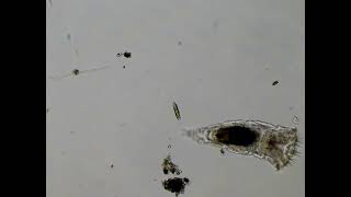 Diatom Becomes a Snack for a Rotifer [upl. by Rexford]