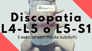 Discopatia L4L5 o L5S1 3 esercizi utili fin da subito [upl. by Wilkins]