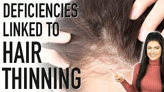 HAIR THINNING  5 Nutrient Deficiencies Linked to Hair Loss and how to fix it [upl. by Melisande]