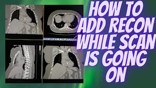 How to add Recon while scan is going on in GE CT Scan machine ctscan radiologytechnologist [upl. by Budde]