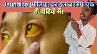 jaundice पीलिया का इलाज सिर्फ एक ही वीडियो में।DrsrkDrSrkiz9cl [upl. by Demp]