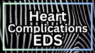 Heart issues with Ehlers Danlos Syndromes [upl. by Eilah508]