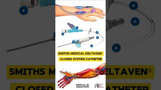 Smiths Medical DeltaVen® Closed System Catheter medical animation 3d short  BiologywithAliya [upl. by Ami]