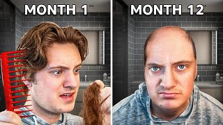 How To Tell if You Are Going BALD amp how to fix it [upl. by Eaned291]