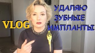 VlogПРОБЛЕМЫ С ЗУБНЫМИ ИМПЛАНТАМИОПЕРАЦИЯ №1  УДАЛЕНИЕ И ЧИСТКА [upl. by Kiker568]