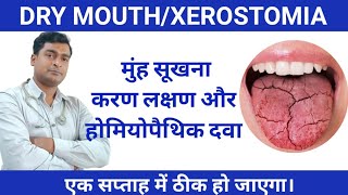 Dry mouth Treatment Muh sukhne ke Karan or illaj Xerostomia Best homeopathic medicine [upl. by Diamante]