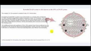 1020 electrode placement system used in electroencephalography EEG test [upl. by Atinrev]