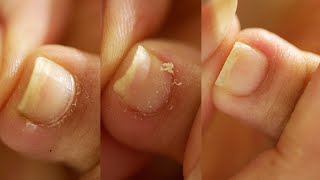 AT HOME PEDICURE  Detailed Cuticle Work [upl. by Hermosa761]