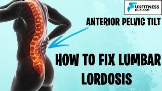 How To Fix Lumbar Lordosis and Anterior Pelvic Tilts  Full Exercise and Stretch Plan [upl. by Aira]