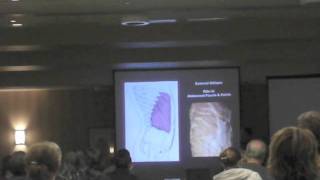 Abdominal Fascia  Anatomy amp Function  Carl DeRosa [upl. by Melanie]