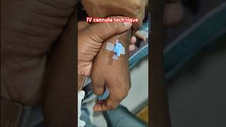 IV cannula technique IV cannula kaise lagate hain viralvideo shorts cannula medicaldevice [upl. by Attenaz]