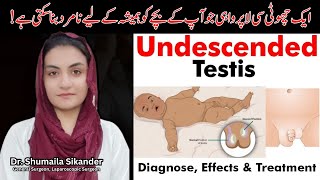 Undescended Testicle  Undescended Testis ka ilaj  Dr Shumaila Sikandar [upl. by Eriha]