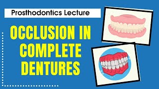 Occlusion in Complete Dentures  Prosthodontics Lecture  Dr Manase [upl. by Asit]