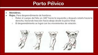 ⚕️🩺 Parto PélvicoParto de Nalgas  Ginecología [upl. by Ueih]