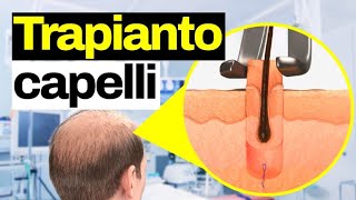 Si sradicano i bulbi con una sorta di levatorsoli  il TRAPIANTO DEI CAPELLI [upl. by Seka]