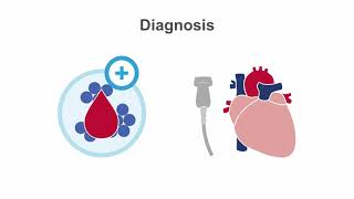 Endocarditis 101 Diagnosis and Treatment [upl. by Aduhey461]