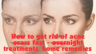 How to get rid of pimples scars fast  treatments home remedies over night treatment [upl. by Adnawt248]