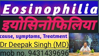 Eosinophilia medicine for eosinophilia treatment for eosinophilia  Dr Deepak Prasad Singh [upl. by Viglione]