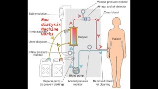 How Dialysis machine works [upl. by Voltmer]