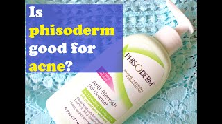 Is phisoderm good for acne [upl. by Adaval999]