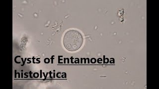 Cysts of Entamoeba histolytica  Saline wet mount  labmedicine9265 [upl. by Balfore]