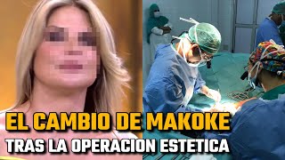 🔴 Makoke MUESTRA el resultado de su última OPERACIÓN ESTÉTICA tras tres SEMANAS de RECUPERACIÓN [upl. by Verlie]