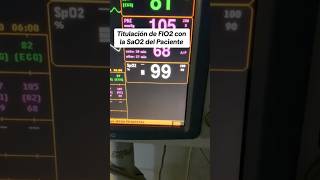 Modificando la FiO2 en el Ventilador Mecánico estudiantedeenfermeria ventilacionmecanica [upl. by Gyasi]