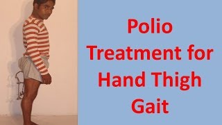 Polio Treatment for Hand Thigh Gait [upl. by Sparks]