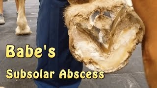 Babes Subsolar Abscess Part 1 [upl. by Jose]