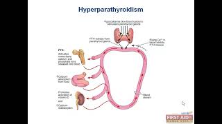 Thyroid Cancer Hyperparathyroidism endocrine Pathology Video part 4 from USMLE First Aid Step one [upl. by Crellen]