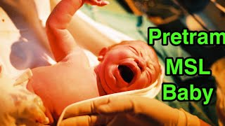 Premature MSL Baby  NEWBORN BABY  NICU viralvideo disease baby [upl. by Purdy]