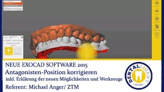 Exocad 2015  AntagonistenPosition korrigieren by Michael Anger [upl. by Htennaj]