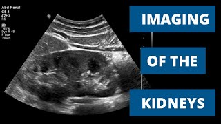 How to Image the Kidneys  When to Use Ultrasound CT and MRI [upl. by Codie218]