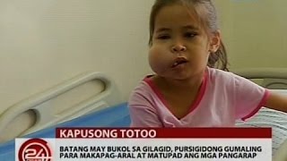 Batang may bukol sa gilagid pursigidong gumaling para makapagaral at matupad ang mga pangarap [upl. by Zoi]