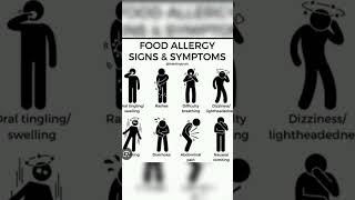 FOOD ALLERGY SIGNS AND SYMPTOMS medicos common people [upl. by Inaj261]