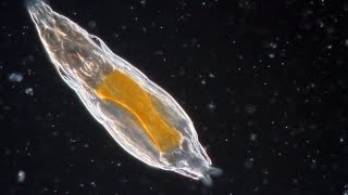 Bdelloid Rotifers so common yet so weird [upl. by Faustine]