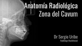 Radiologia Anatomia Cavum [upl. by Gaston]